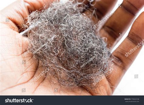 193 Cycle Hair Loss Women Images, Stock Photos & Vectors | Shutterstock