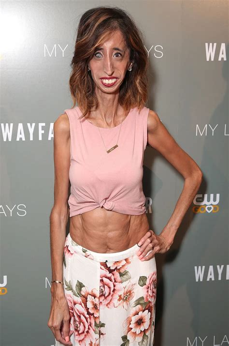 Lizzie Velasquez, Once Called the ‘World’s Ugliest Woman,’ Responds to ...