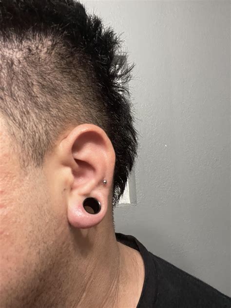 Cysts inside lobe?? : r/Stretched