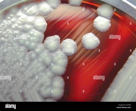 Bacteria Hemolysis Blood Agar at Isabel Kleeman blog