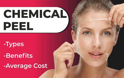 Chemical Peel: A Guide To The Effective Skin Treatment - Sakhiya Skin ...
