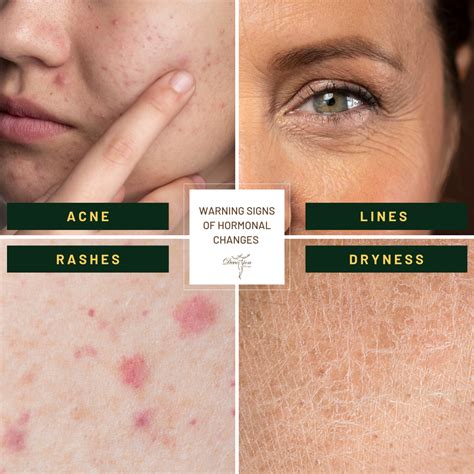 Peri-M Series for Perimenopause Skin Problems - Devotion Beautique