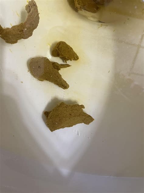Tiny Black Specks in stool : r/poop