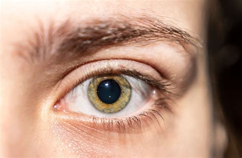 Do Optometrists Always Dilate Your Eyes for an Eye Exam?