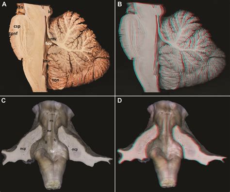 3D Simulation of Fiber Dissection of the Cerebellum and Brainstem | The Neurosurgical Atlas