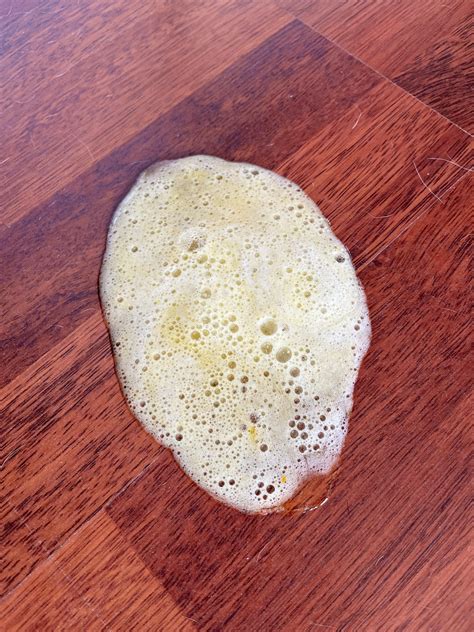 What Does It Mean When Your Dog Throws Up Yellow Liquid