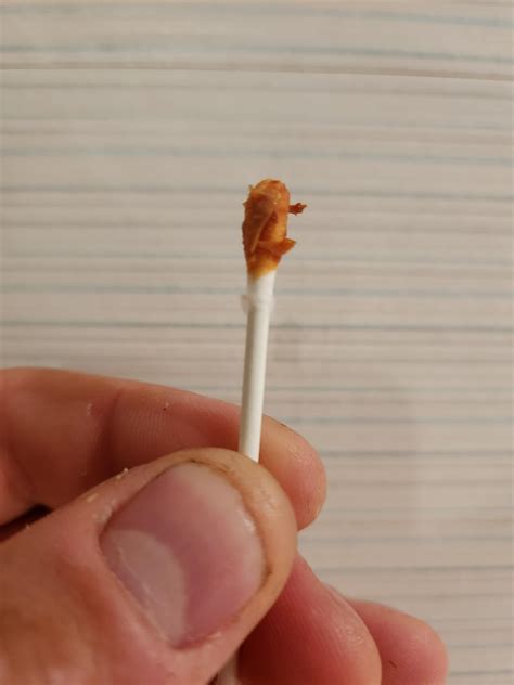 What is this??? : r/earwax