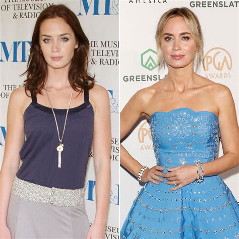 Has Emily Blunt Had Plastic Surgery? Transformation Photos | Life & Style