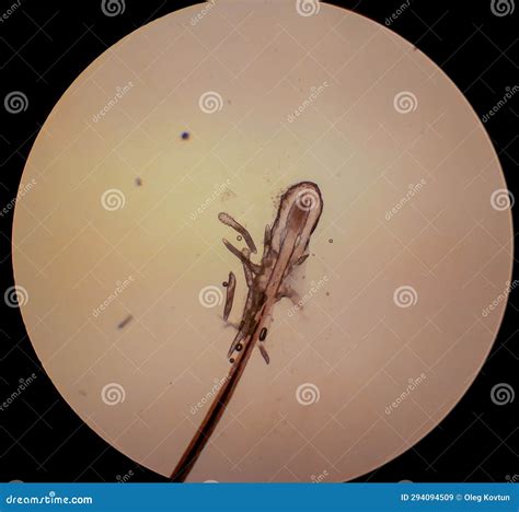 Demodex Folliculorum - Parasitic Mite on the Eyelashes of a Human Eye Stock Image - Image of ...