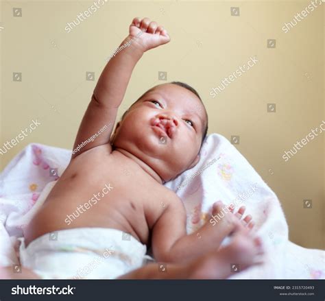13 Toddler Cleft Palate Images, Stock Photos & Vectors | Shutterstock