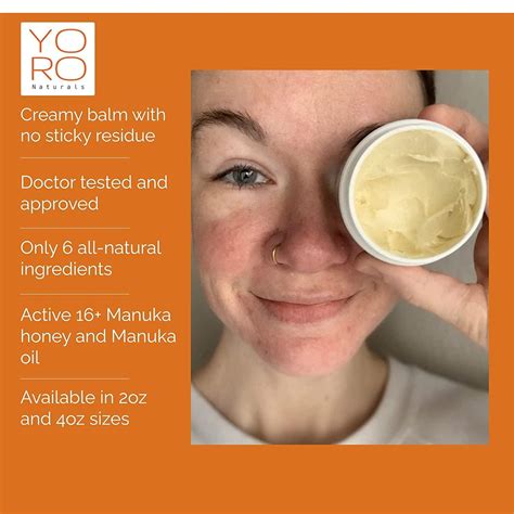 Organic Manuka Skin Soothing Cream for Dry Itchy Skin, Rosacea & Sensitive Skin - Honey Eczema ...