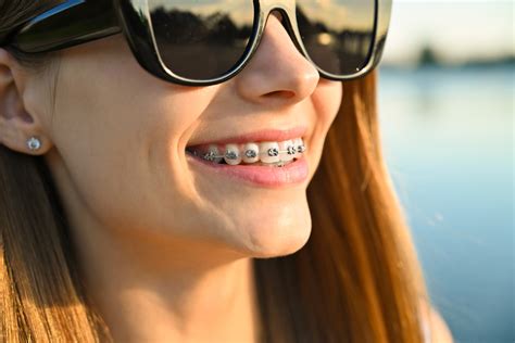 Braces Jacksonville FL | Coastline Orthodontics | Top Rated