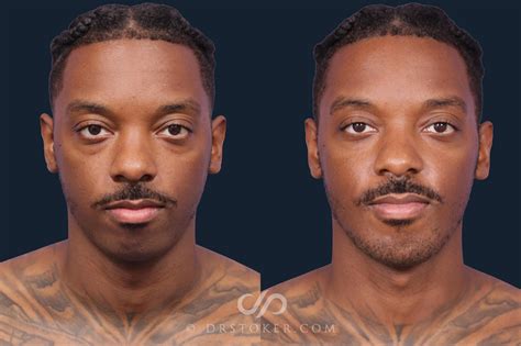 Jwoww Plastic Surgery Before And After Photos Latest