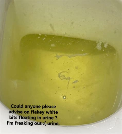 White flaky floaty bits in urine, please advise : r/kidney
