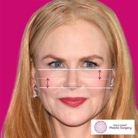 Types Of Low Cheekbones – High And Low Cheekbones – LTAX