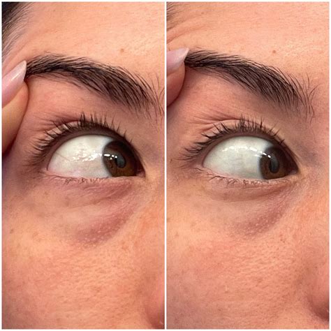 Lumify Eye Drops Review: See Photos | PS Beauty
