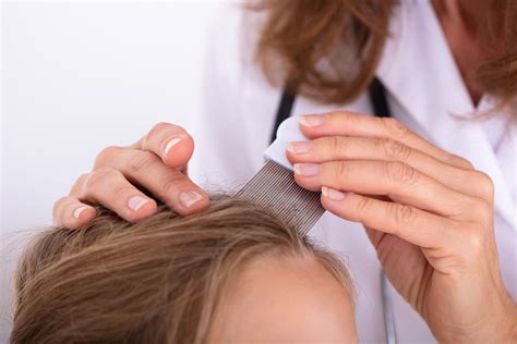 Get Rid of Lice Fast | Kill Lice and Eggs Naturally at Home with Essential Oils, Vinegar, Olive ...