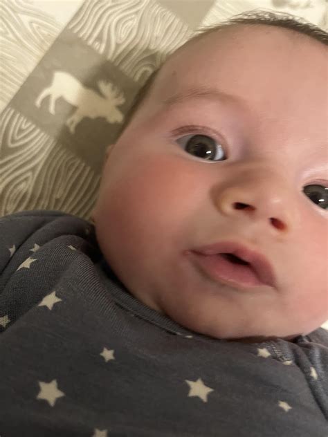 Does my baby have cold sores of angular cheilitis? : r/DermatologyQuestions