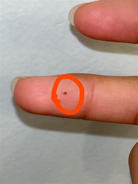 should i be concerned ? i’ve never noticed this before until maybe around 2 months ago. i have ...