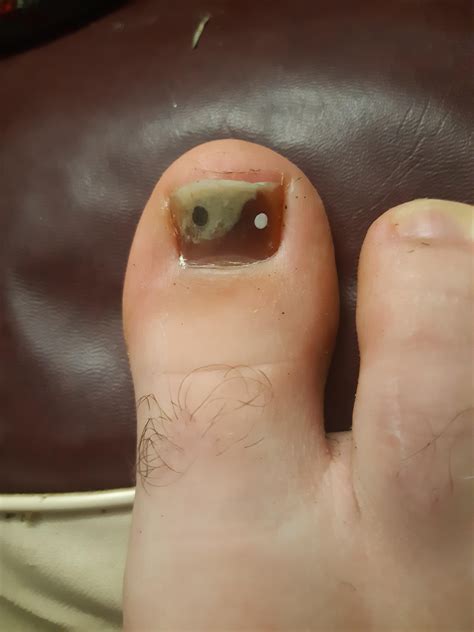 Thought I'd make my peeling bruised toenail look nice. Made a yin and yang. Thoughts? : r ...