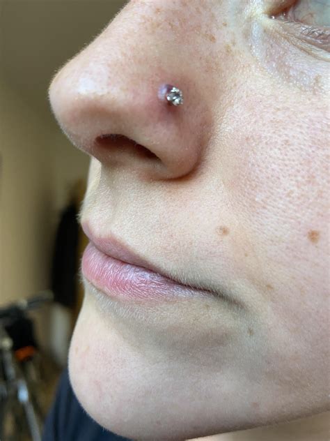 Bad Nose Piercing Infection