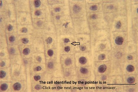 Onion Cell Metaphase Mitosis, Cell Cycle, Biology