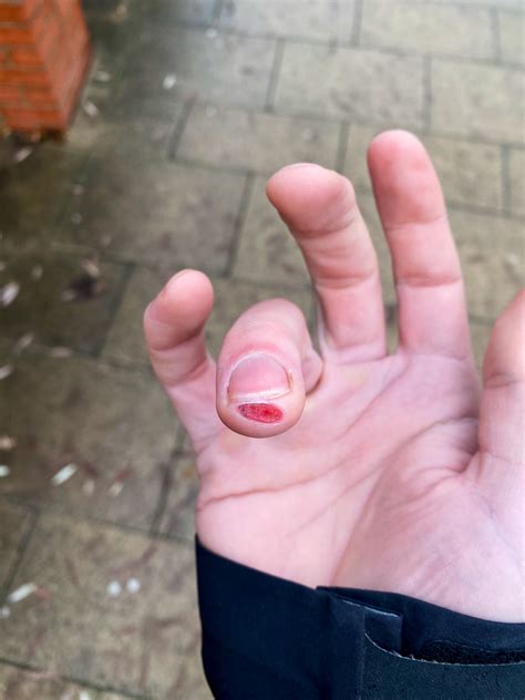 Finger Cut Off