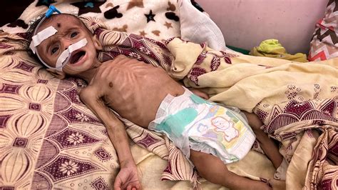 Babies are starving as Yemen teeters on brink of collapse - while Houthis use Gaza crisis to ...