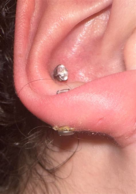 What’s going on with my 3rd lobe piercing? : r/piercing