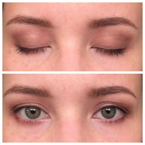 How To Fix Uneven Eyelids