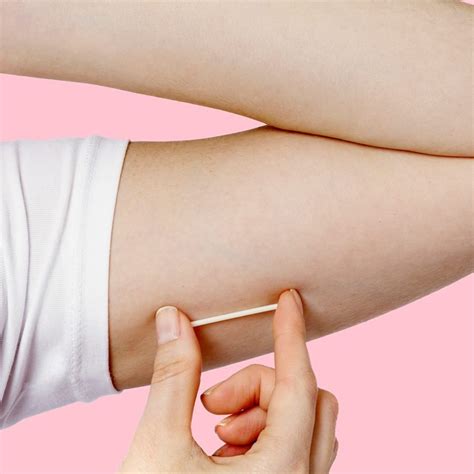 Nexplanon Implants - Serviam