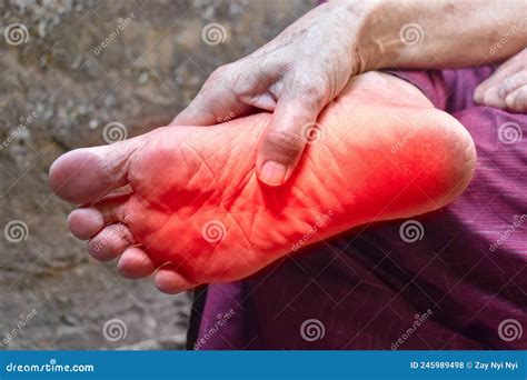 Tingling And Burning Sensation In Foot Of Asian Man. Foot Pain. Sensory Neuropathy Problems ...