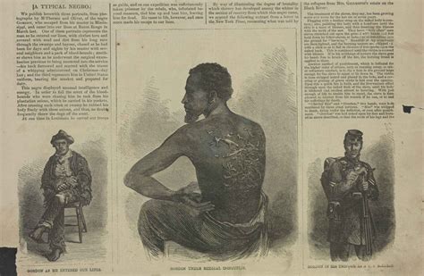The Shocking Photo of 'Whipped Peter' That Made Slavery's Brutality ...