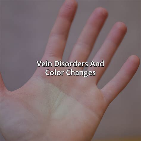 What Color Is Your Veins - colorscombo.com