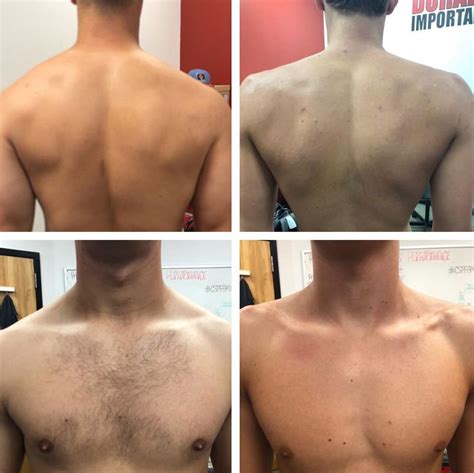 What Is Considered Broad Shoulders? — Outlive