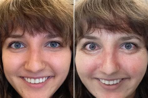 Flushed Face After Alcohol at Ty Pace blog