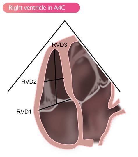Standard Transthoracic Echocardiogram: Complete Imaging Protocol – ECG & ECHO
