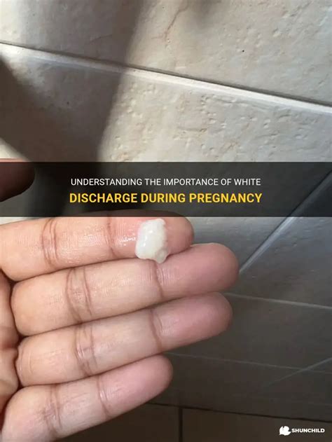 Understanding The Importance Of White Discharge During Pregnancy ...