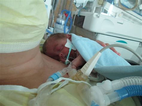 JAM sessions: Lessons learned through a micro-preemie: Week 8 (31 weeks ...