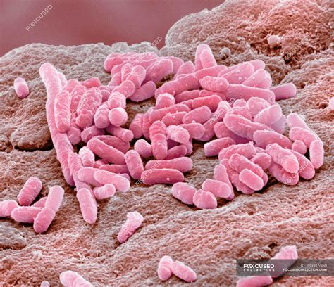 E Coli Micrograph