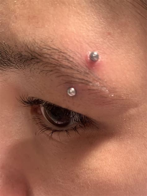 swollen and irritated eyebrow piercing. (info underneath post) : r/piercing