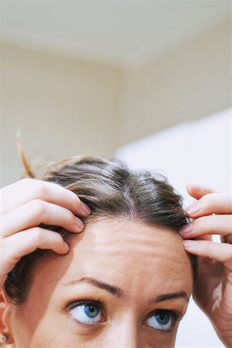 Fun Tips About How To Treat Scalp Pimples - Commonlab23