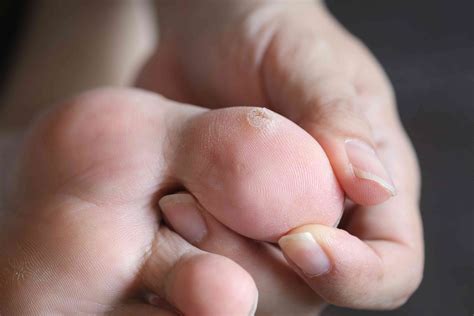 17 Common Causes of Raised Skin Bumps (With Pictures)