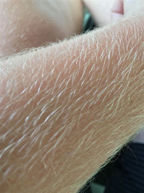 White Arm and Leg Hair