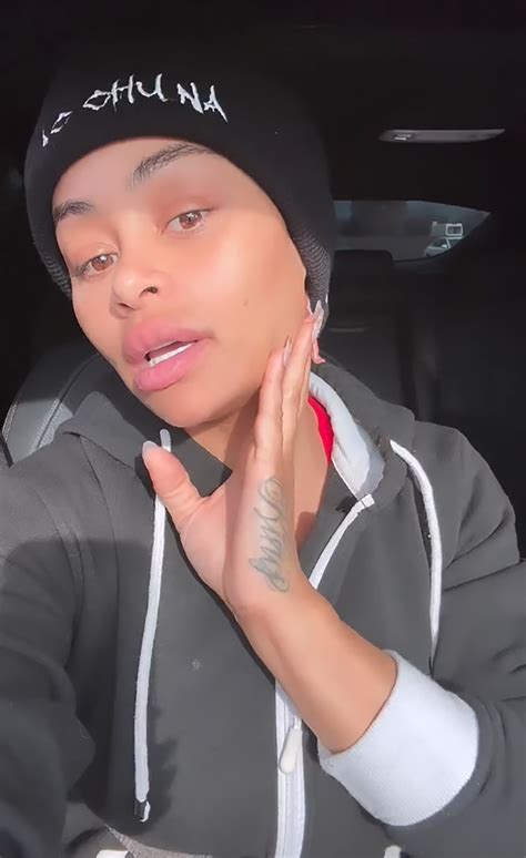 Blac Chyna shows off face amid 'Round 2' of dissolving fillers