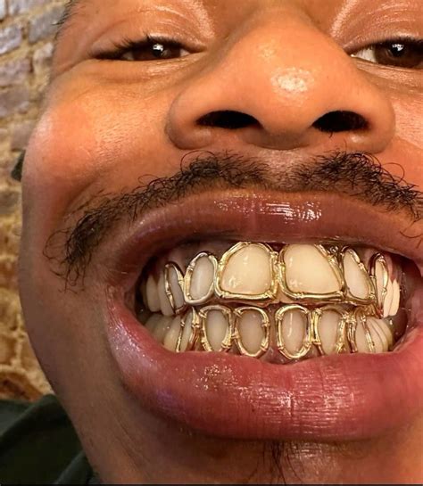 Pin by Limpho Luvuyo on Grillz in 2025 | Gold teeth grillz, Grillz ...