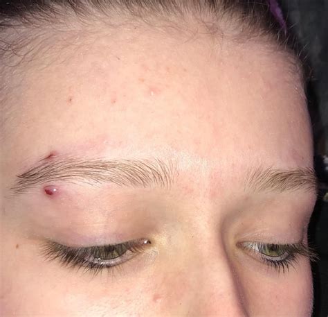 is my piercing infected? : r/piercing