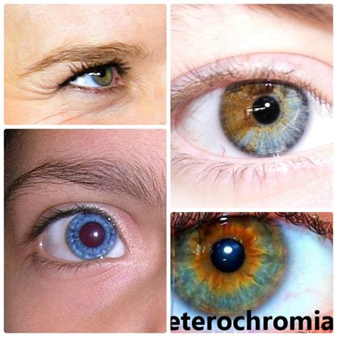 Wie Viele Menschen Haben Heterochromie – Limmerkoll