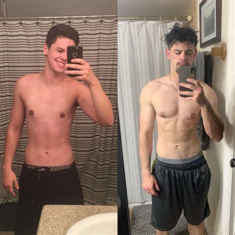 Ftm Surgery Bottom Cost at Kenneth Neilson blog