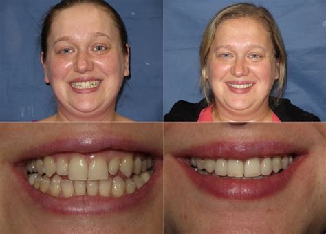 Dental Professionals Of Lincoln Park at Anna Beyers blog